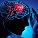 विश्व अल्जाइमर दिवस- दिमागी तंदुरुस्ती के लिए इन योगासनों का करें अभ्यास